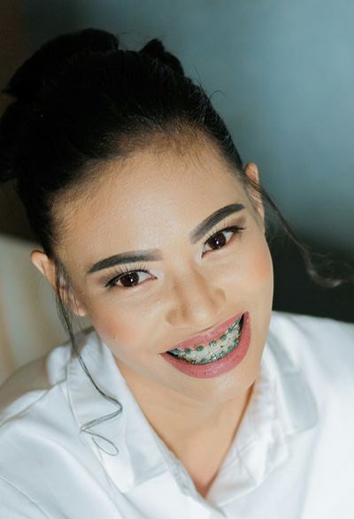 Image of woman in braces by Rainier Ridao via Unspash